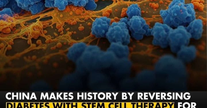 BREAKING: China Makes History by Reversing Diabetes with Stem Cell Therapy